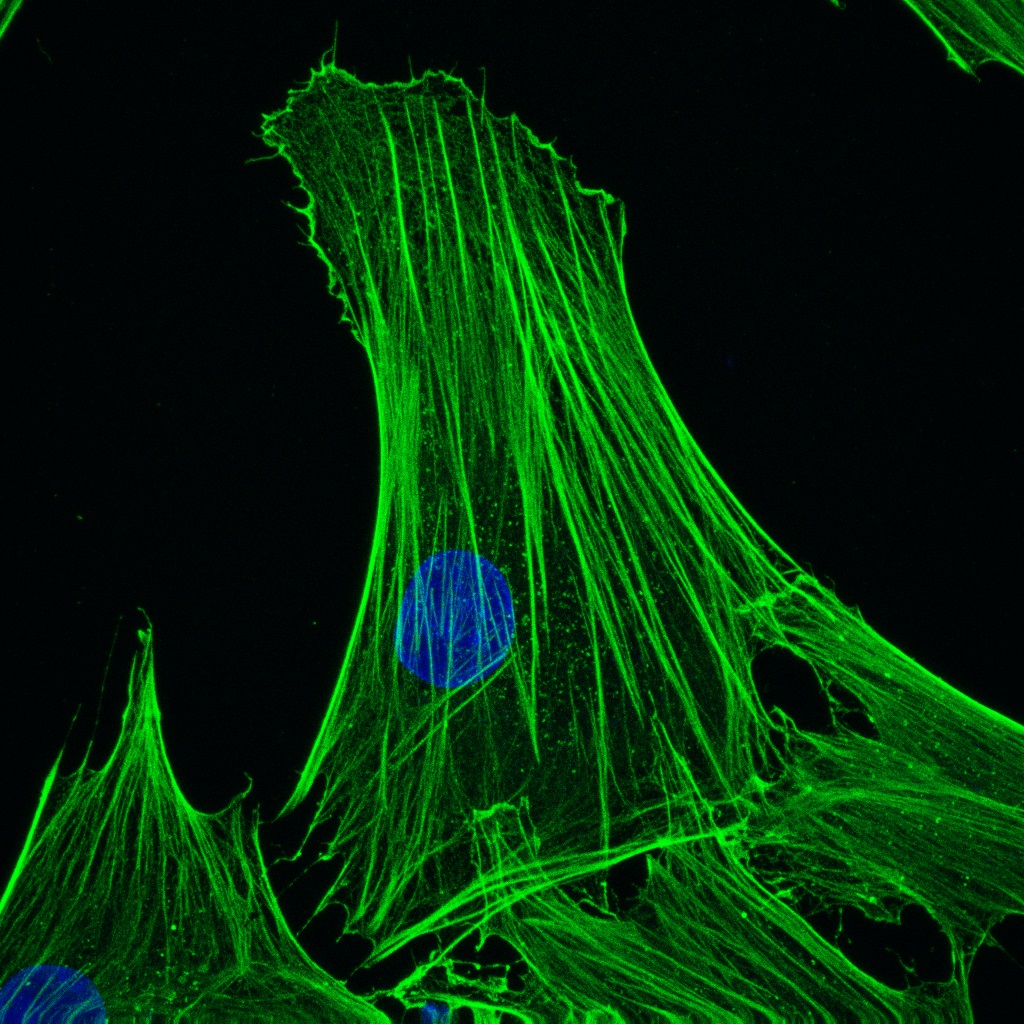 Figure 2. MUB0110P (clone 4C2) immunostaining of human fibroblasts in cell culture. Note the strong reactivity for beta cytoplasmic actin in the stress fibers of the cytoskeleton.